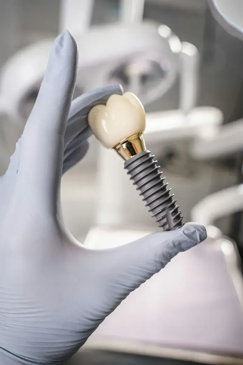 Dental implant treatment in Viman Nagar at Dr. Varun's Dental Clinic