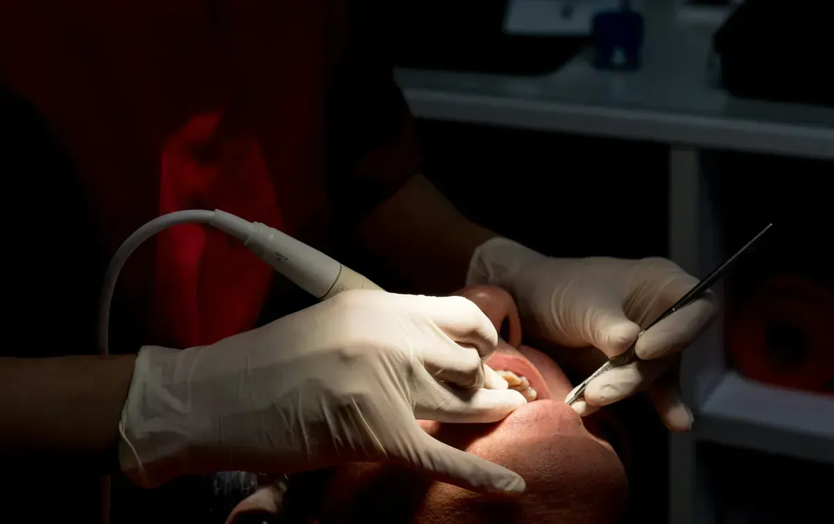 Deep gum scaling, teeth cleaning, and fluoride application in Viman Nagar Pune at Dr. Varun's Dental Clinic
